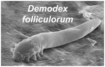 Τα παράσιτα Demodex προκαλούν βλεφαρίτιδα, ξηροφθαλμία, μαδάρωση, χαλάζιο, βλέφαρο-επιπεφυκίτιδα