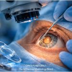 Επέμβαση καταρράκτη: πώς να προετοιμάσετε σωστά τα μάτια πριν το χειρουργείο.